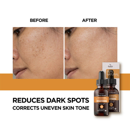 Purifect Brightening Vitamin C Facial Serum